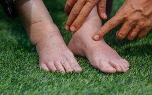 10 aliments pour éliminer la rétention d'eau