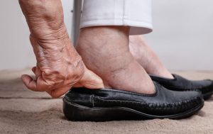 Astuces pour éviter la rétention de liquides