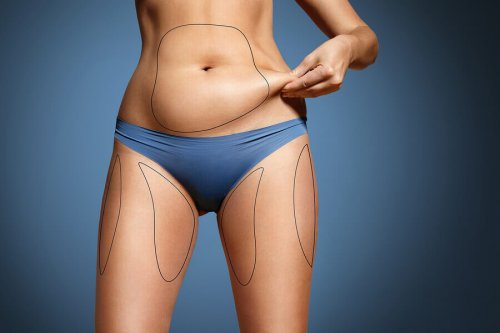 Quels sont les niveaux de graisse corporelle appropriés ?