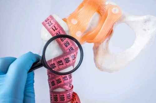 L'ostéoporose qui affecte la résistance des os.