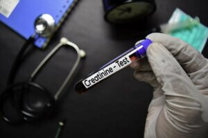 Créatinine : est-elle dangereuse pour la santé ?